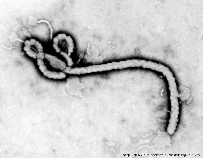 вирус Эбола